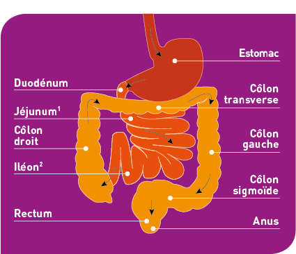 schma_ilocolo image colostomie