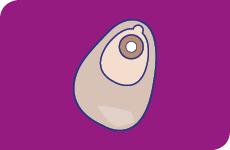 Appareillage 1 pi&egrave;ce colostomie