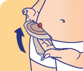 uro_soin_tape_8-1 Soins