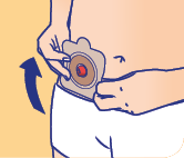 uro_soin_tape_8-2 Soins