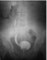 art.v1_suivi-des-vessies Suivi des vessies neurologiques